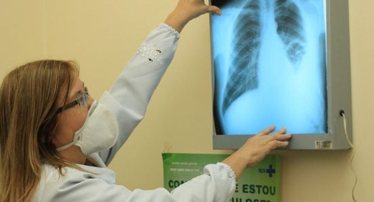 brasil-esta-na-contramao-da-meta-da-oms-para-extincao-da-tuberculose