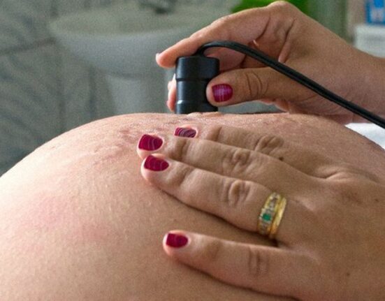 saude-recomenda-calcio-para-todas-as-gestantes-para-prevenir-eclampsia
