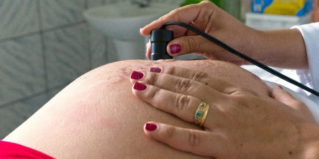 saude-recomenda-calcio-para-todas-as-gestantes-para-prevenir-eclampsia