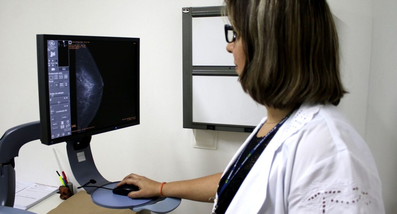 entidades-medicas-pedem-faixa-etaria-maior-para-mamografia-de-rastreio