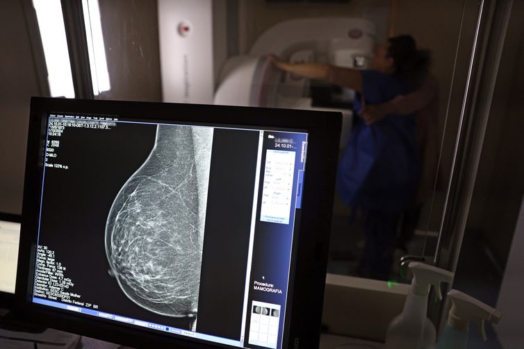 Brasília (DF), 01/10/2024 - Teste de mamografia realizado na Campanha Outubro Rosa: Sesc-DF, que oferece exames e consultas gratuitas às mulheres.  Foto: José Cruz/Agência Brasil