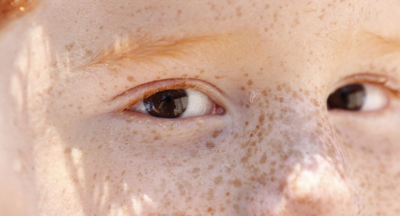 reflexo-branco-nos-olhos:-entenda-condicao-que-assusta-pais