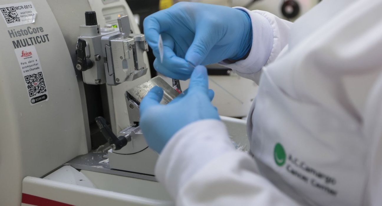 cura-de-cancer-de-prostata-pode-chegar-a-ate-98% 