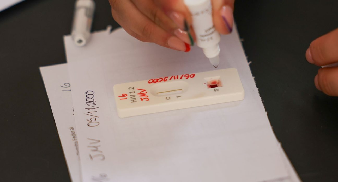 acao-no-df-oferece-testagem-rapida-e-informacao-sobre-hiv/aids