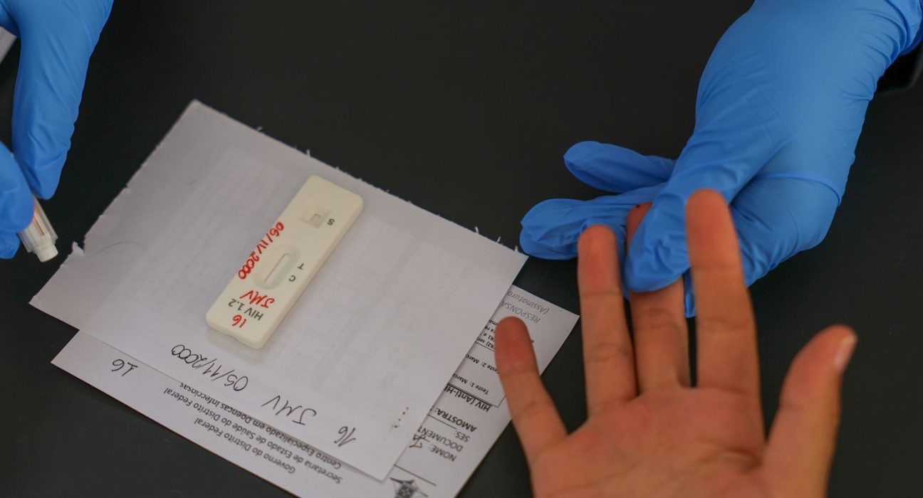 hiv/aids:-brasil-vai-insistir-em-acordo-por-prep-de-longa-duracao