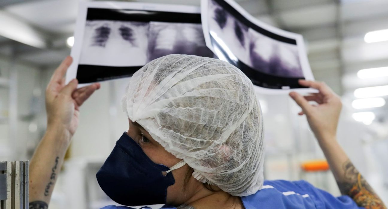 brasil-deve-ter-781-mil-novos-casos-de-cancer-por-ano-ate-2028