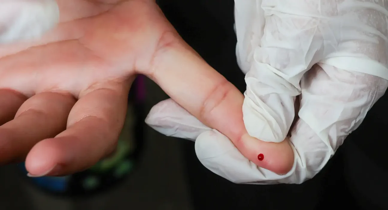 teste-rapido-de-dengue-passa-a-integrar-tabela-do-sus