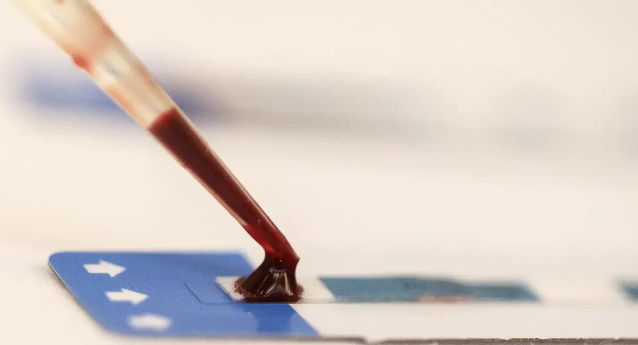 estudo-inedito-da-fiocruz-pode-ampliar-prevencao-de-hiv-entre-jovens
